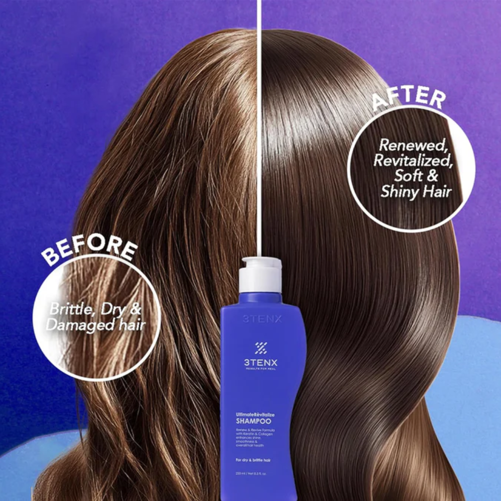 3Tenx Ultimate Revitalize Shampoo for Dry & Brittle Hair – UK Fast Shipping | MyPharmacyUSA